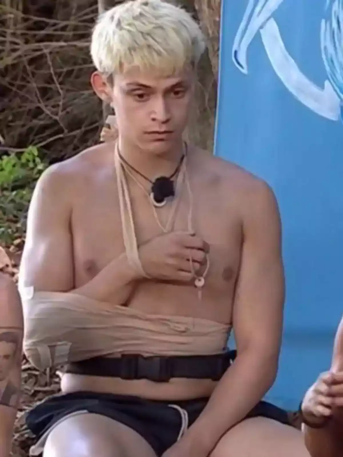 Un joven con el cabello rubio y corto está sentado al aire libre, lleva un cabestrillo en el brazo izquierdo y un micrófono en el pecho, parece estar participando en una actividad o programa. Un joven con el cabello rubio y corto está sentado al aire libre, lleva un cabestrillo en el brazo izquierdo y un micrófono en el pecho, parece estar participando en una actividad o programa.