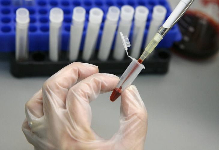 Johnson&Johnson comienza antes de 2020 las pruebas de su vacuna contra el VIH