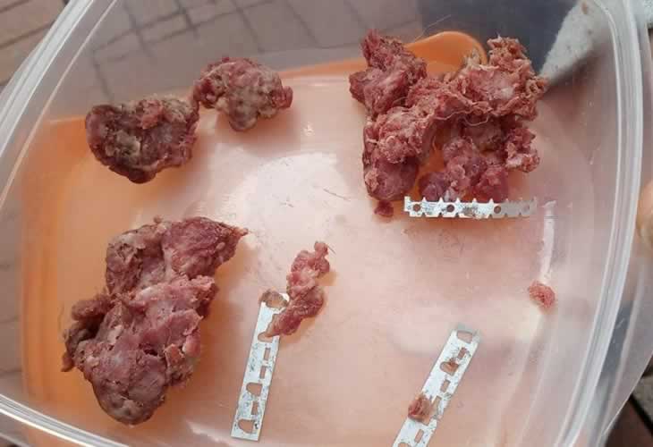 ¡¡Ojo!! Encuentran carne con veneno y materiales cortantes en las calles de esta ciudad española