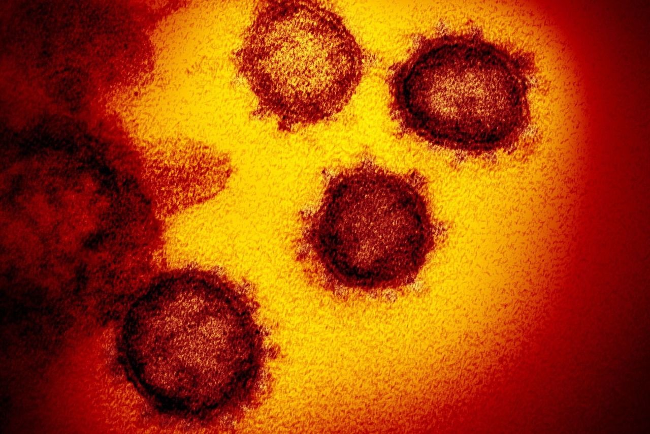 ¿Es cierto que puedes contraer el coronavirus a través de las heces?