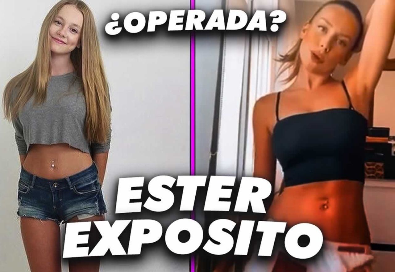 ¿Qué operaciones estéticas se ha hecho Ester Expósito?