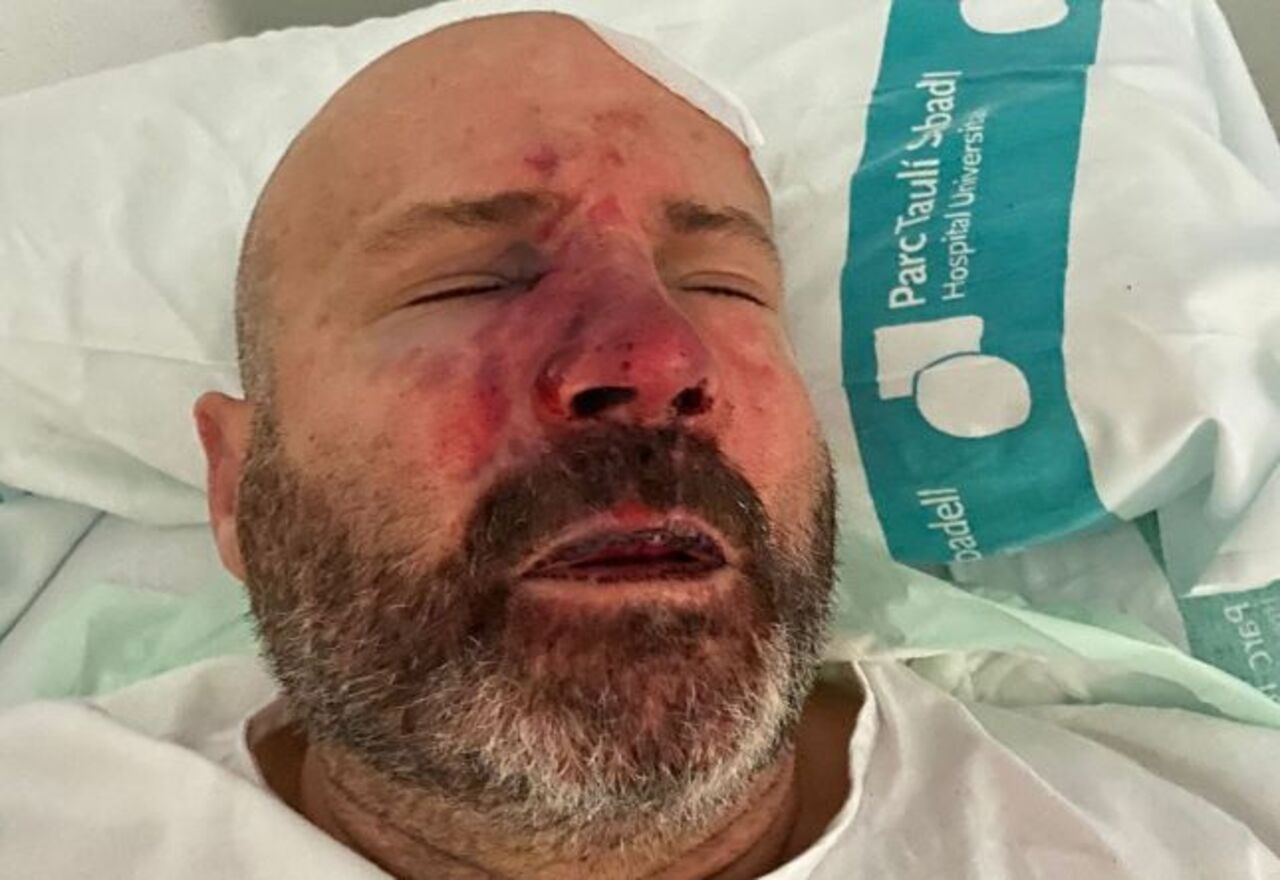 Un taxista de Sabadell, agredido por dos jóvenes: ingresado en urgencias con la nariz y dos costillas rotas