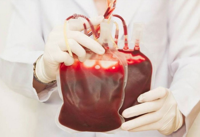 ¿Cuándo se hizo la primera transfusión de sangre?